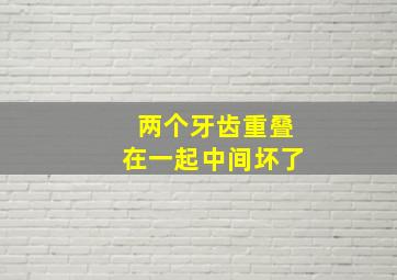 两个牙齿重叠在一起中间坏了