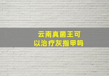 云南真菌王可以治疗灰指甲吗