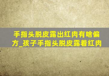 手指头脱皮露出红肉有啥偏方_孩子手指头脱皮露着红肉