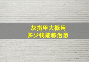 灰指甲大概用多少钱能够治愈