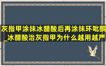 灰指甲涂抹冰醋酸后再涂抹环吡酮_冰醋酸治灰指甲为什么越用越严重