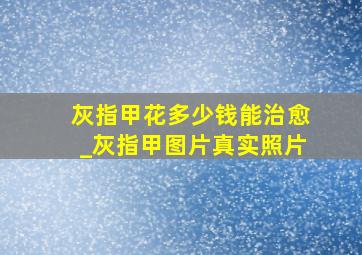 灰指甲花多少钱能治愈_灰指甲图片真实照片