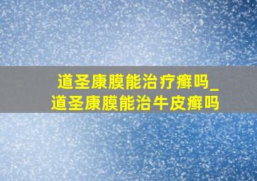 道圣康膜能治疗癣吗_道圣康膜能治牛皮癣吗