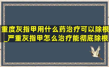 重度灰指甲用什么药治疗可以除根_严重灰指甲怎么治疗能彻底除根