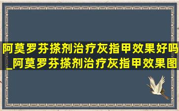 阿莫罗芬搽剂治疗灰指甲效果好吗_阿莫罗芬搽剂治疗灰指甲效果图